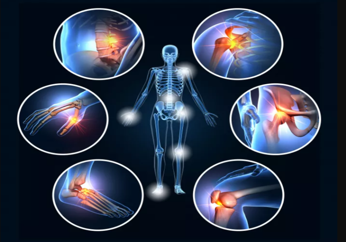 Rheumatoid Arthritis Profile -I