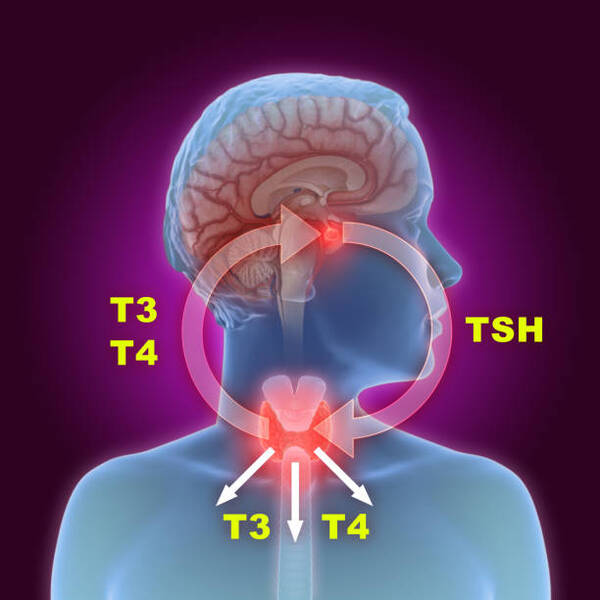 Thyroid Stimulating Hormone(TSH) 