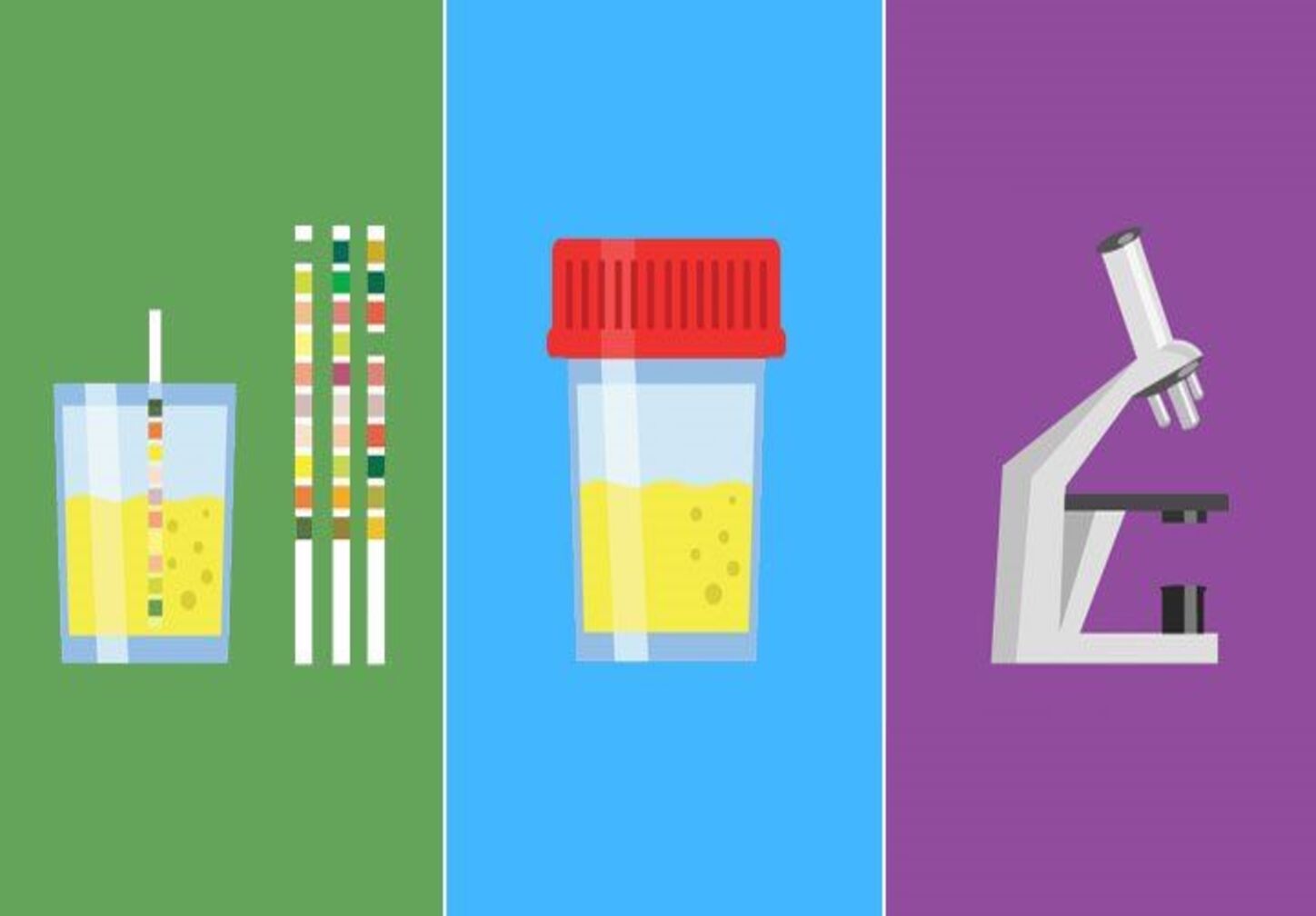 Complete Urine Analysis (CUE)